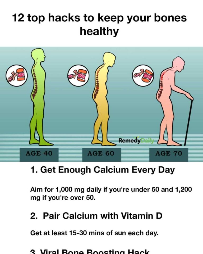 12 top hacks to keep your bones healthy