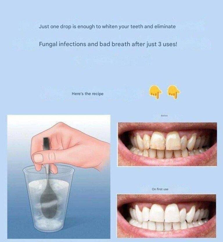 Remove tartar and whiten your teeth with this simple recipe.