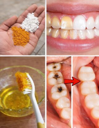 Turmeric for Teeth Whitening: Does This Natural Spice Actually Brighten Your Smile?