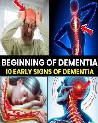 7 EARLY SIGNS of ALZHEIMER’S DISEASE that you SHOULD