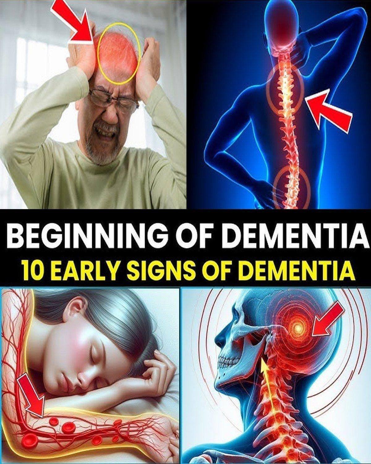 7 EARLY SIGNS of ALZHEIMER’S DISEASE that you SHOULD