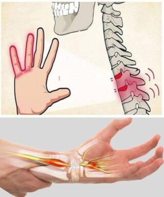 If your HANDS fall asleep it’s a clear sign that you might have… See more👇