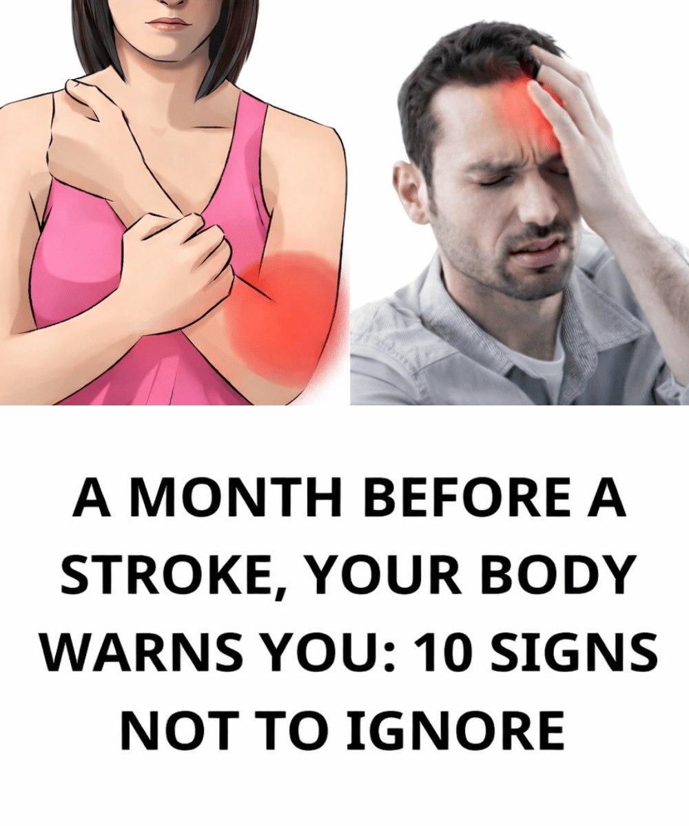 A Month Before a Stroke, Your Body Warns You: 10 Signs Not to Ignore