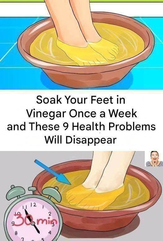 Soak Your Feet in Vinegar Once a Week and Watch These 9 Health Problems Disappear