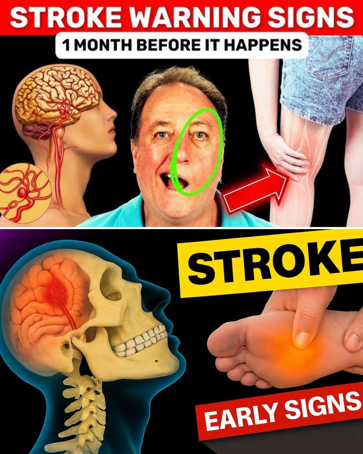 8 Warning Signs of Stroke One Month Before + 9 Powerful Tips to Prevent It