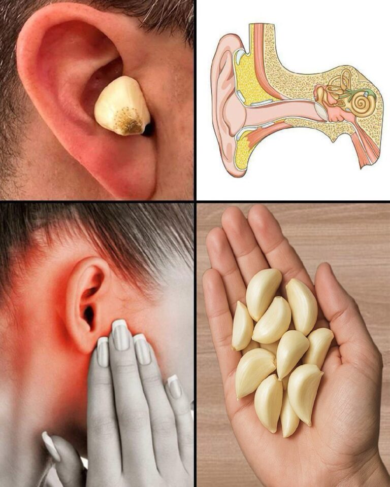 Garlic for Ear Health: Natural Relief and Protection