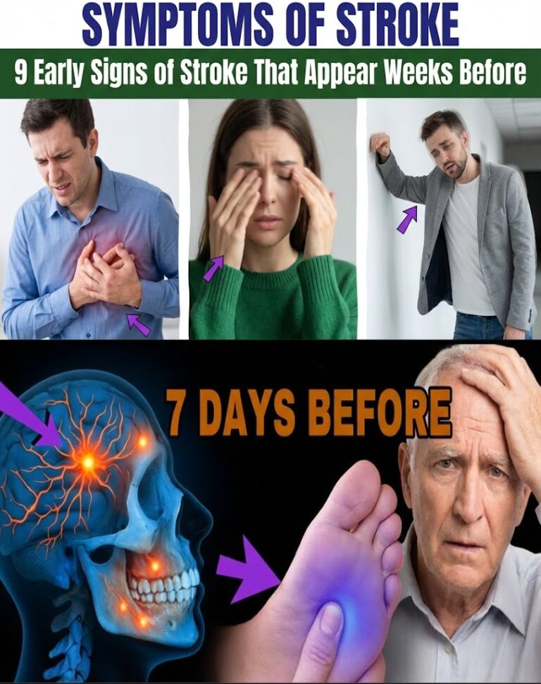 Discover the 9 Early Warning Signs of Stroke That Could Appear a Week Before