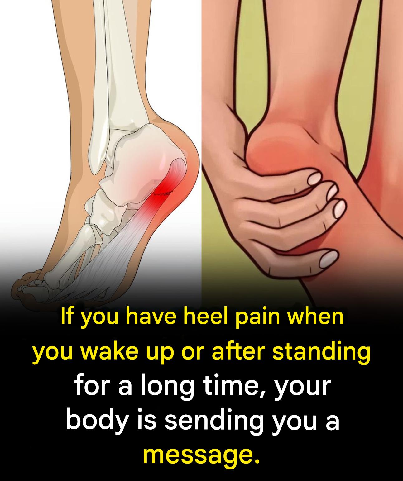 7 effective exercises to relieve heel pain and treat plantar fasciitis naturally