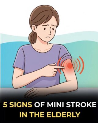 5 Signs of a Mini Stroke in the Elderly