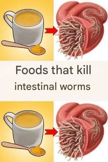 7 Foods That Kill Worms in the Intestine