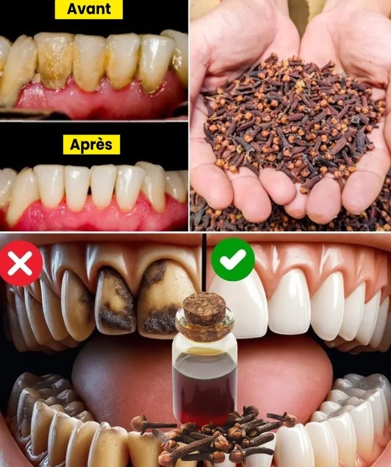 Discover the secret to healthier teeth thanks to the oral health benefits of chewing cloves daily.