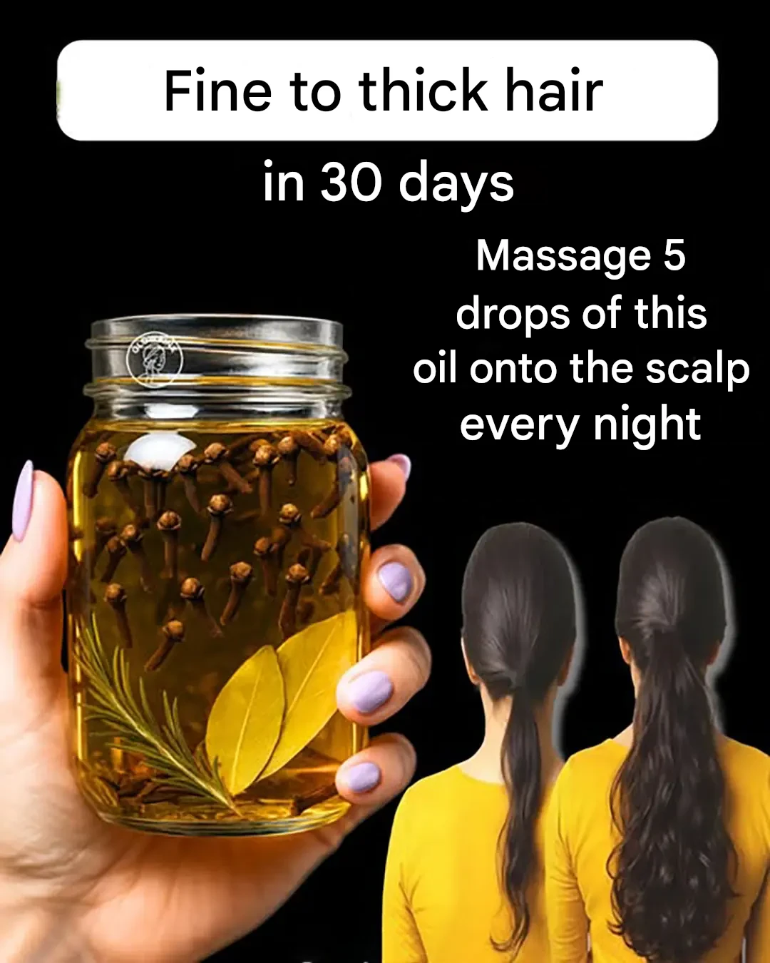 Clove oil, rosemary and bay leaf: to regrow hair on balding areas