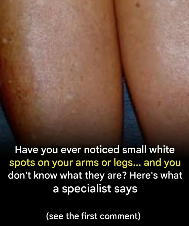 Have you ever noticed small white spots on your arms or legs?