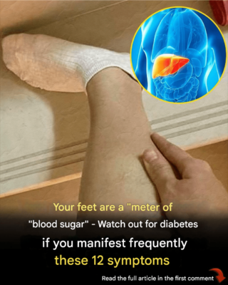 Your Feet Are a “Blood Sugar Meter” – Watch Out for Diabetes If You Frequently Experience These 12 Symptoms Read the full article in the first comment