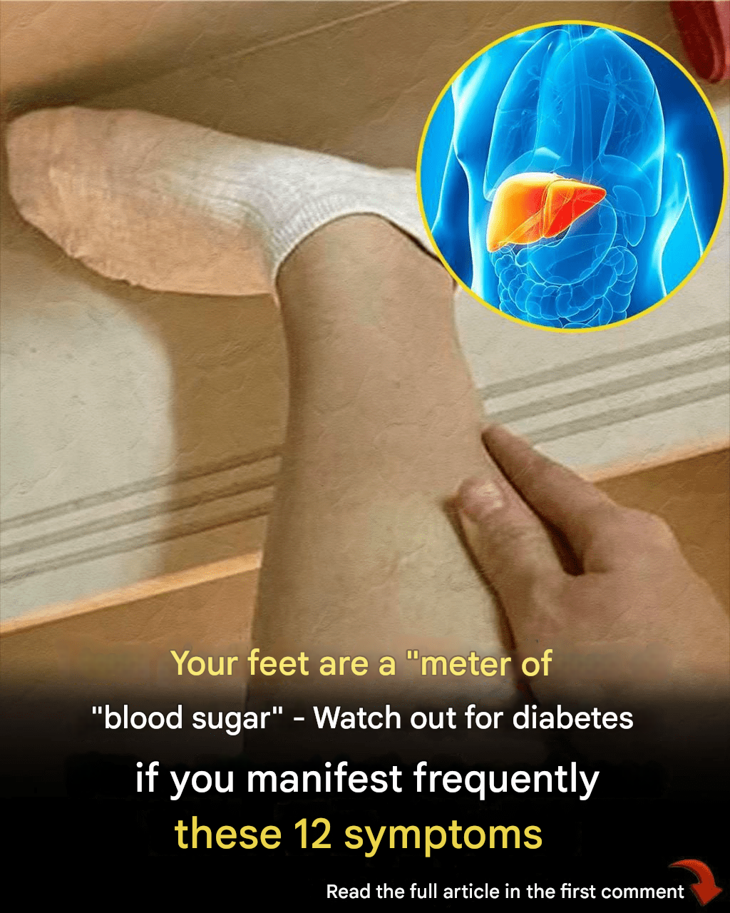 Your Feet Are a “Blood Sugar Meter” – Watch Out for Diabetes If You Frequently Experience These 12 Symptoms Read the full article in the first comment