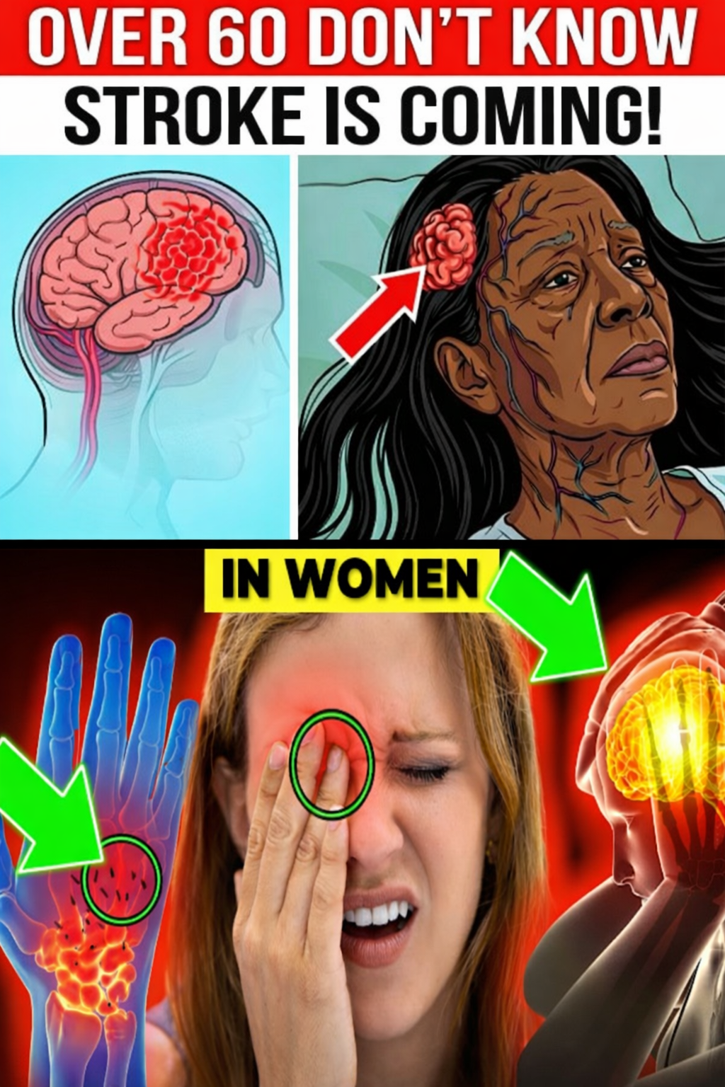 Over 60 Women: 10 Leg Signs That Could Signal a Stroke – Act Before #7