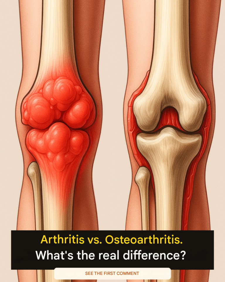 Arthritis or osteoarthritis? The key differences to understand joint pain.